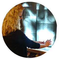 Chiropractor Ames IA Lisa Day GONSTEAD X Rays